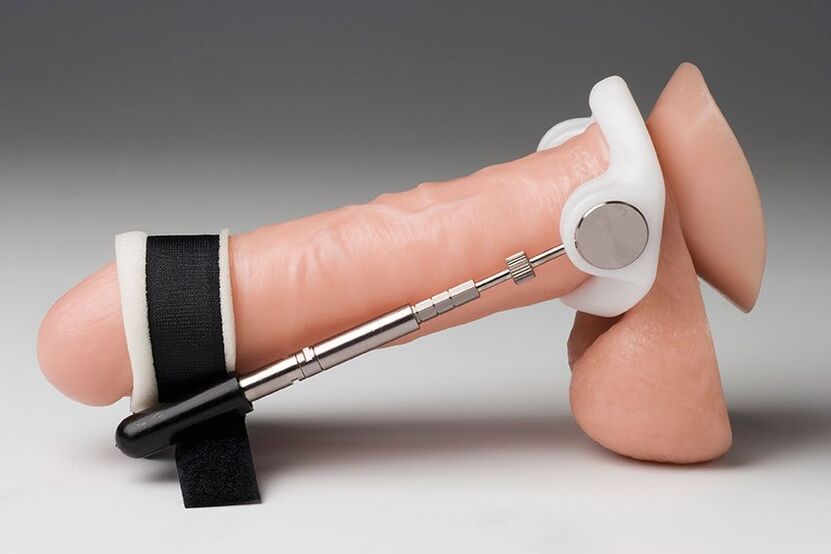 Máis comúnmente, úsanse un extensor e bombas de baleiro para ampliar a cabeza.
